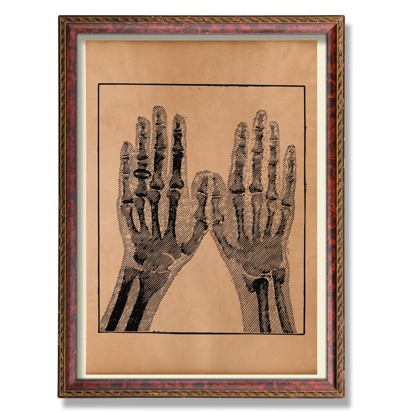 X-ray hands anatomy print Medical art