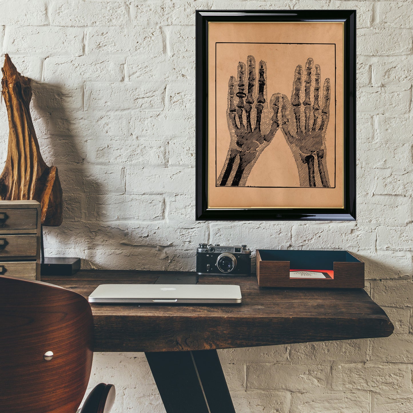 X-ray hands anatomy print Medical art